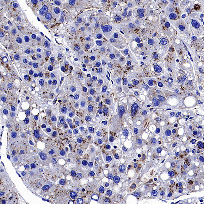 Galactosylceramidase Recombinant Rabbit mAb (S-3402-17)