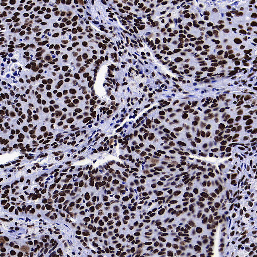 ZMYND8 Recombinant Rabbit mAb (S-5407)