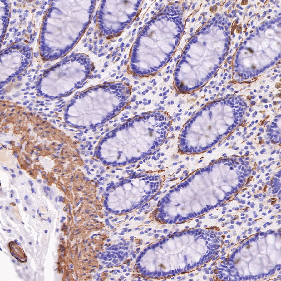 alpha smooth muscle Actin Recombinant Mouse mAb (SDT-R142)