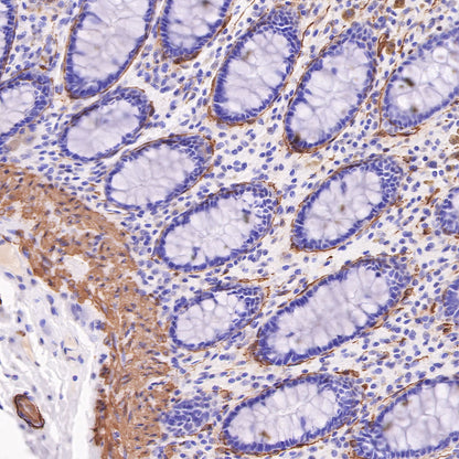 alpha smooth muscle Actin Recombinant Mouse mAb (SDT-R142)