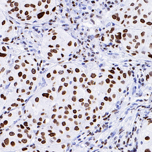 HMGA1 Recombinant Rabbit mAb (S-R332)