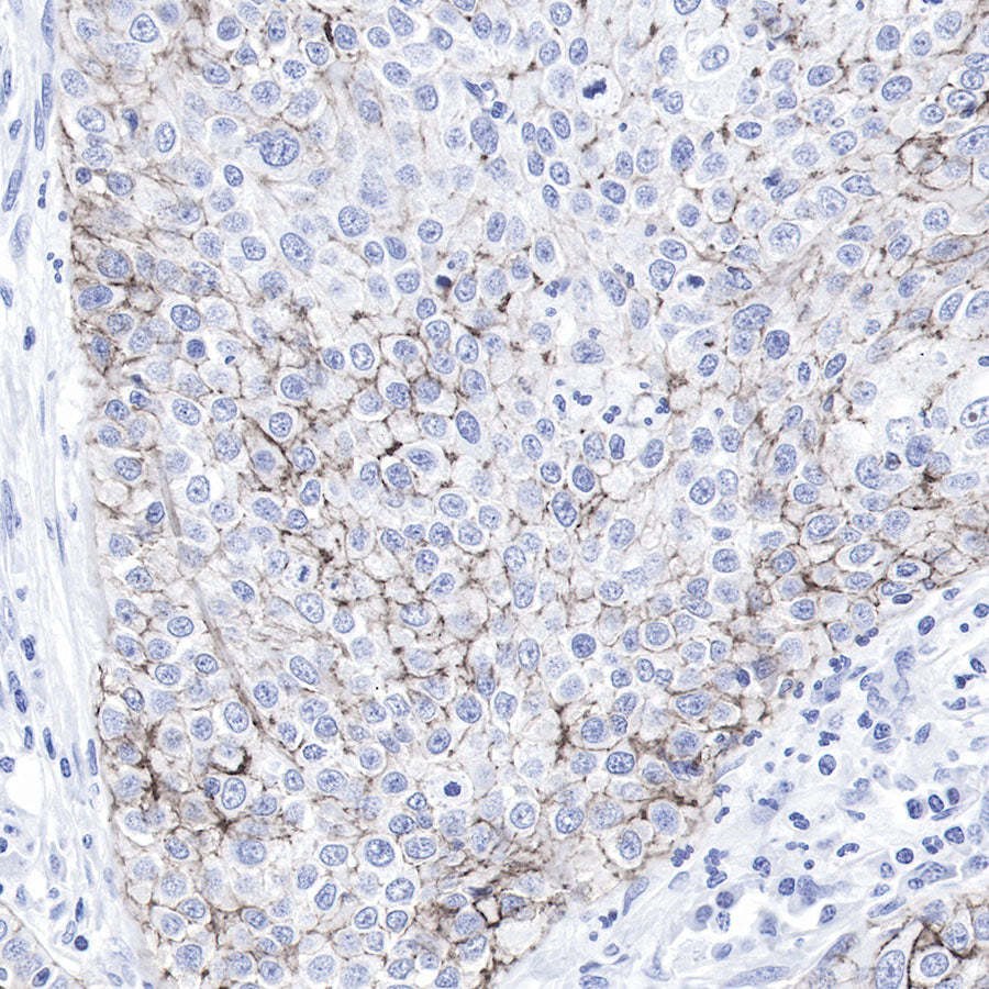 Claudin-1 Recombinant Rabbit mAb,PBS Only (SDT-R024)
