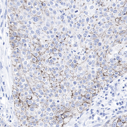 Claudin-1 Recombinant Rabbit mAb,PBS Only (SDT-R024)