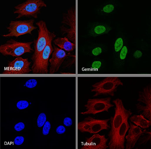 Geminin Recombinant Rabbit mAb (S-427-204)