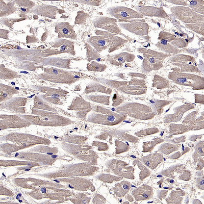 HLA Class I-A Recombinant Mouse mAb (S-3834)