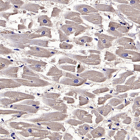 HLA Class I-A Recombinant Mouse mAb (S-3834)