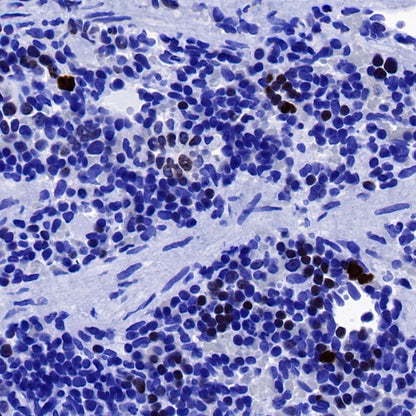 S-RMab® Ki67 Recombinant Rabbit mAb (SDT-R459)