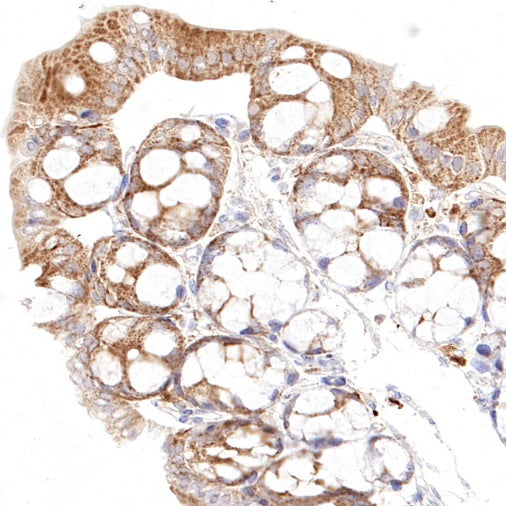 Thioredoxin/TRX Recombinant Rabbit mAb (S-1862-26)