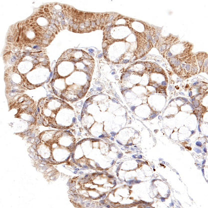 Thioredoxin/TRX Recombinant Rabbit mAb (S-1862-26)
