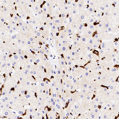 NOX2/gp91phox Recombinant Rabbit mAb (S-2974-75)