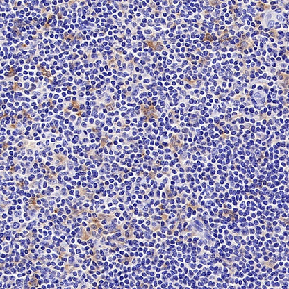 TLR2 Recombinant Rabbit mAb (S-2585-57)