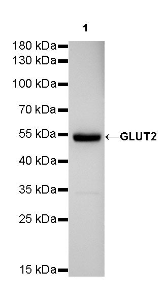 GLUT2 Recombinant Rabbit mAb (SDT-R036)