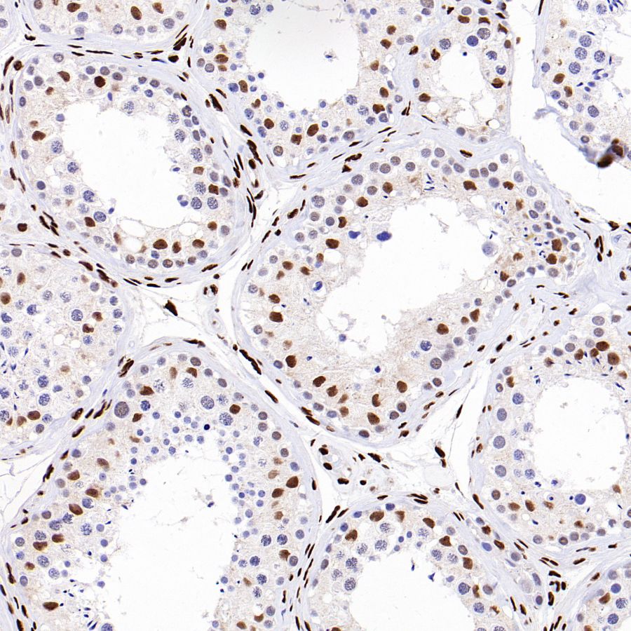 PML Recombinant Rabbit mAb (S-1908-60)