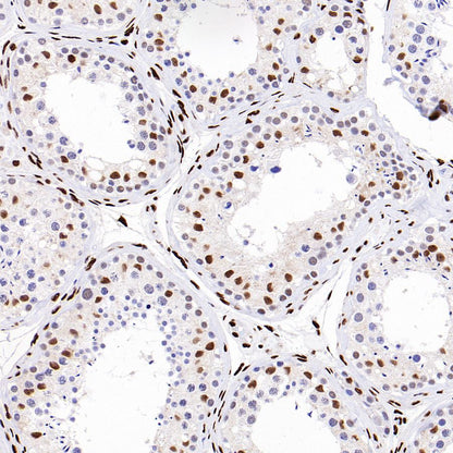 PML Recombinant Rabbit mAb (S-1908-60)