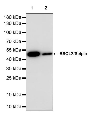 BSCL2/Seipin Recombinant Rabbit mAb (S-1669-46)