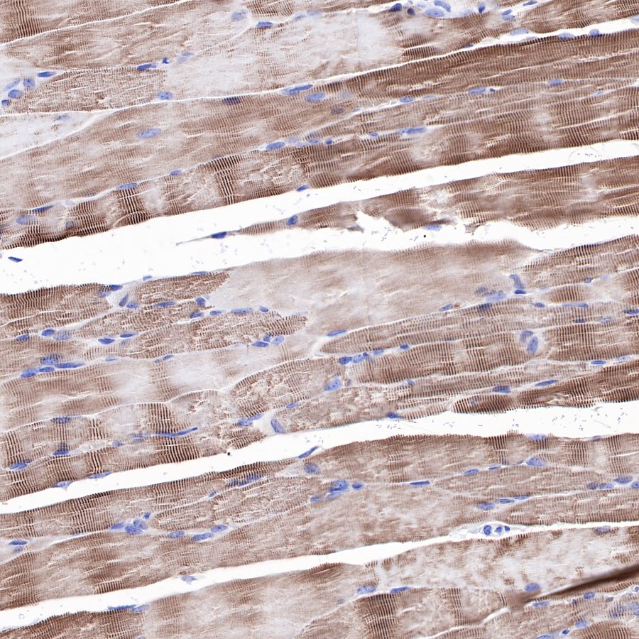 alpha-actinin-2 Recombinant Rabbit mAb (SDT-032-79)