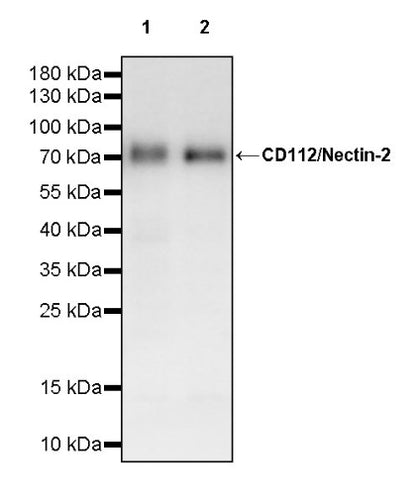 CD112/Nectin-2 Recombinant Rabbit mAb (S-2404-66)
