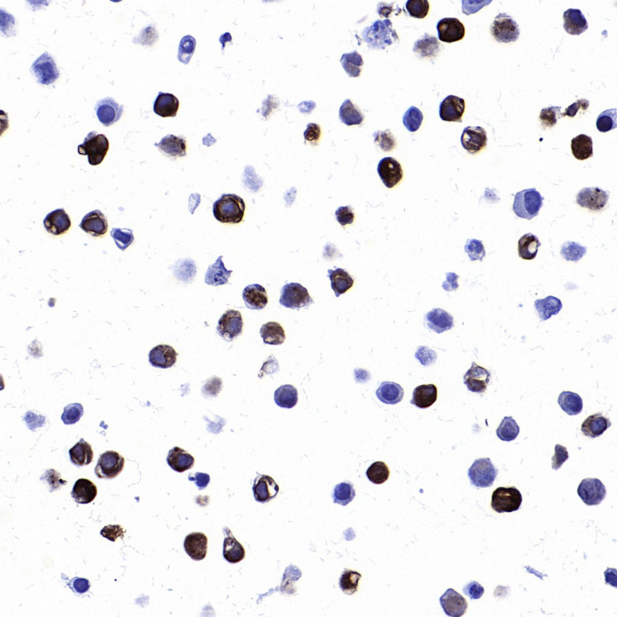 STEAP1 Recombinant Rabbit mAb (S-3613-107)