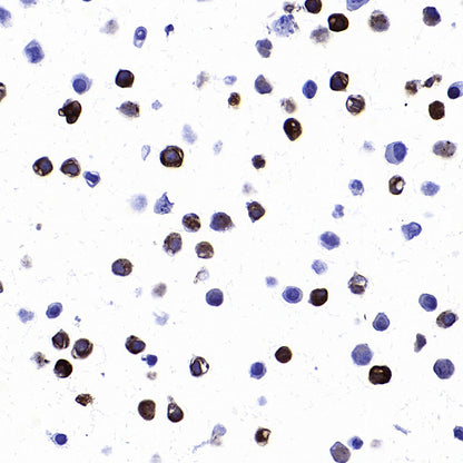 STEAP1 Recombinant Rabbit mAb (S-3613-107)