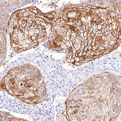 Desmoglein 3 Recombinant Rabbit mAb (SDT-3213-33)
