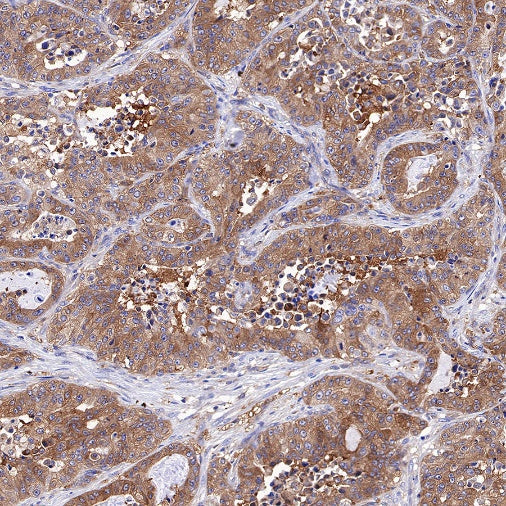 Atg7 Recombinant Rabbit mAb (S-R302)