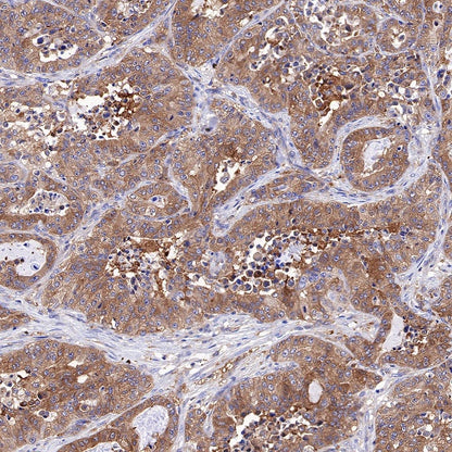 Atg7 Recombinant Rabbit mAb (S-R302)