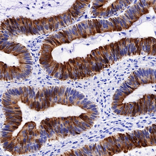 CK8/18 Recombinant Rabbit mAb (SDT-P005)