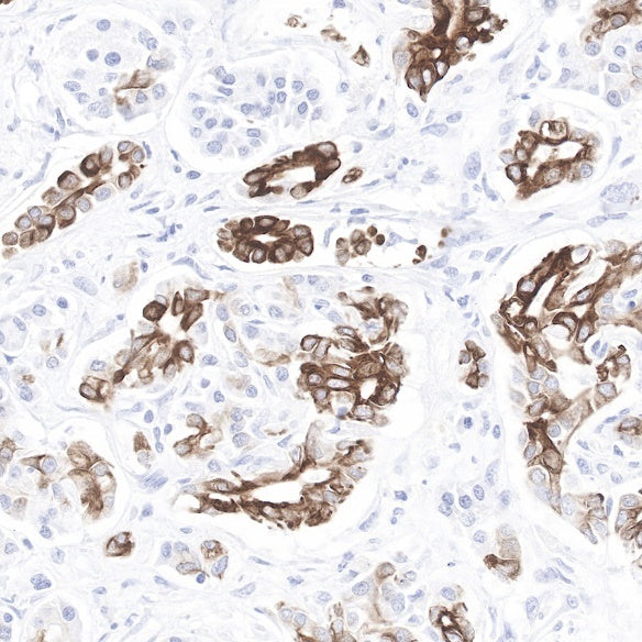 Cytokeratin 7 Recombinant Rabbit mAb (SDT-R028)