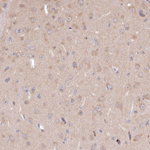 PP2A C Subunit Rabbit polyclonal antibody