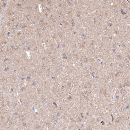 PP2A C Subunit Rabbit polyclonal antibody