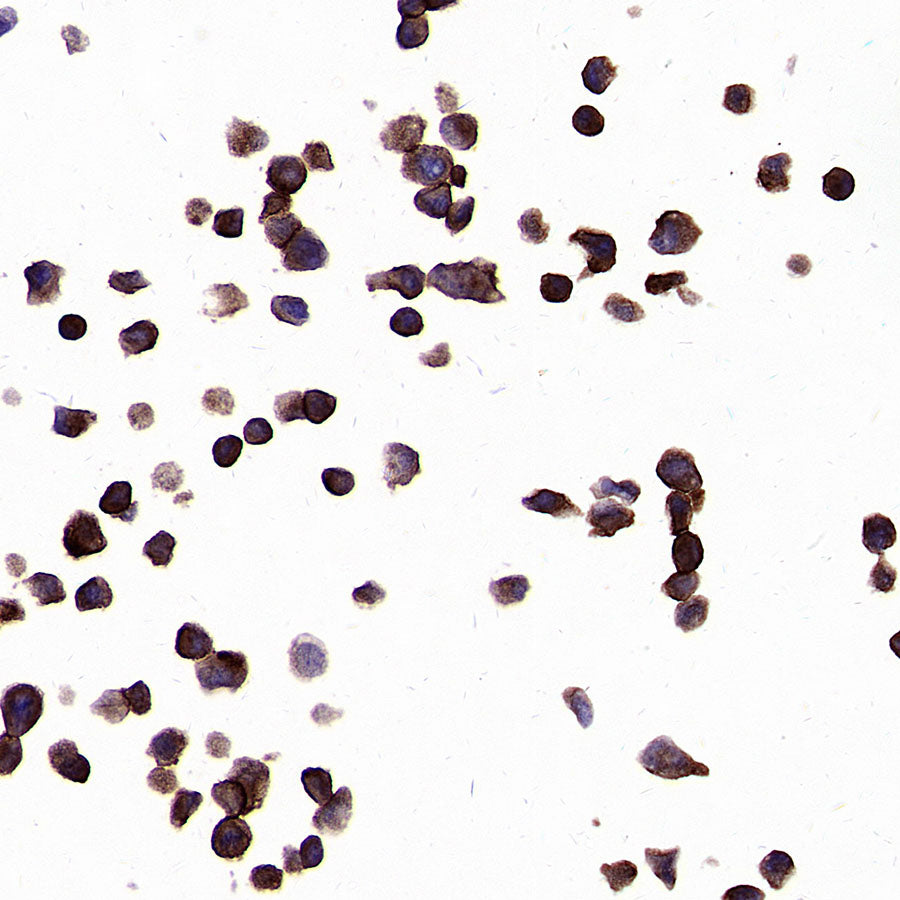 PTK7 Recombinant Rabbit mAb (SDT-2432-136)