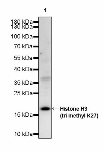 Histone H3 (tri methyl K27) Recombinant Rabbit mAb (S-4098)
