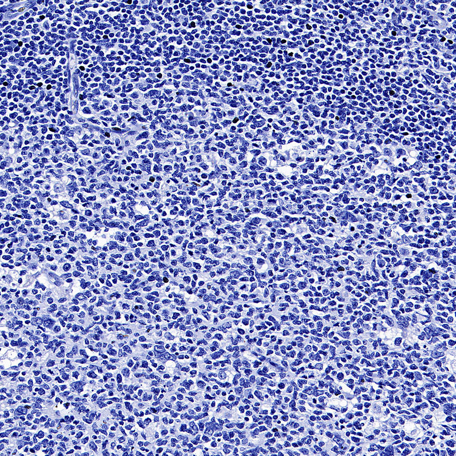TSH Receptor/TSH-R Recombinant Rabbit mAb (S-5699)