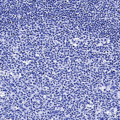 TSH Receptor/TSH-R Recombinant Rabbit mAb (S-5699)