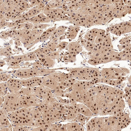 PSMB5 Rabbit Polyclonal Antibody
