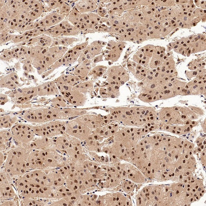 PSMB5 Rabbit Polyclonal Antibody