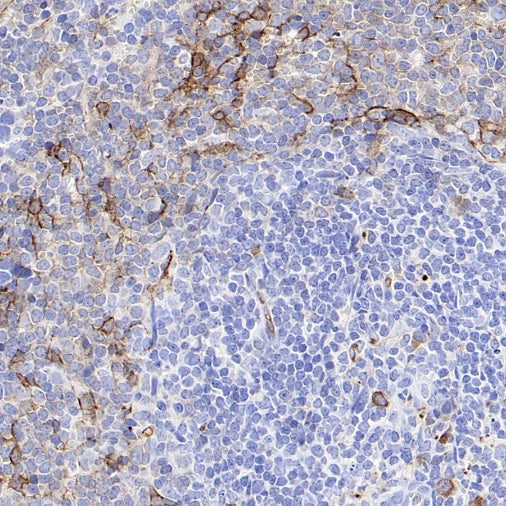 CD36 Recombinant Rabbit mAb (S-1028-127)