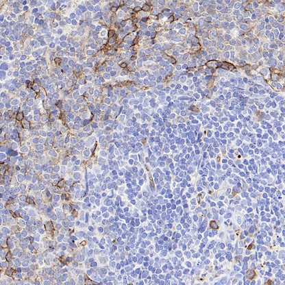 CD36 Recombinant Rabbit mAb (S-1028-127)
