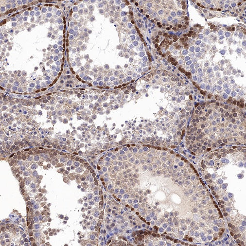 JNK1 Recombinant Rabbit mAb (S-1153-21)