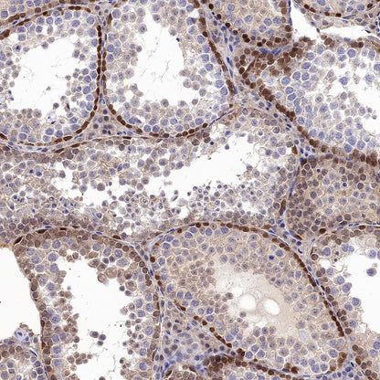 JNK1 Recombinant Rabbit mAb (S-1153-21)