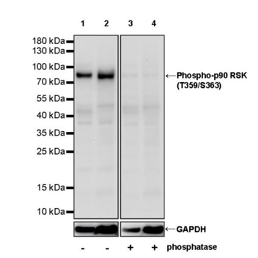 Phospho-p90 RSK (T359/S363) Recombinant Rabbit mAb (S-985-212)