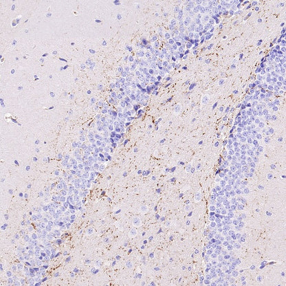 VGLUT3 Recombinant Rabbit mAb (S-2430-26)