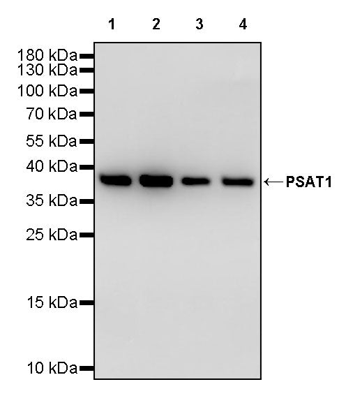 PSAT1 Recombinant Rabbit mAb (S-3054-5)
