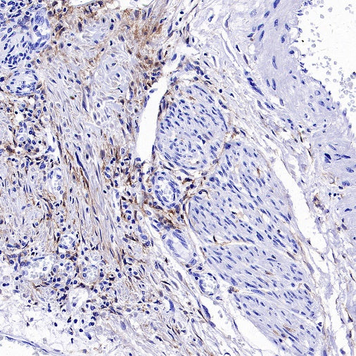 PDGFR alpha Recombinant Rabbit mAb (SDT-3353)