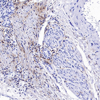 PDGFR alpha Recombinant Rabbit mAb (SDT-3353)