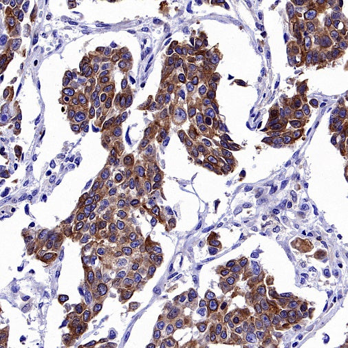 Claudin 9 Recombinant Rabbit mAb (S-2849-16)