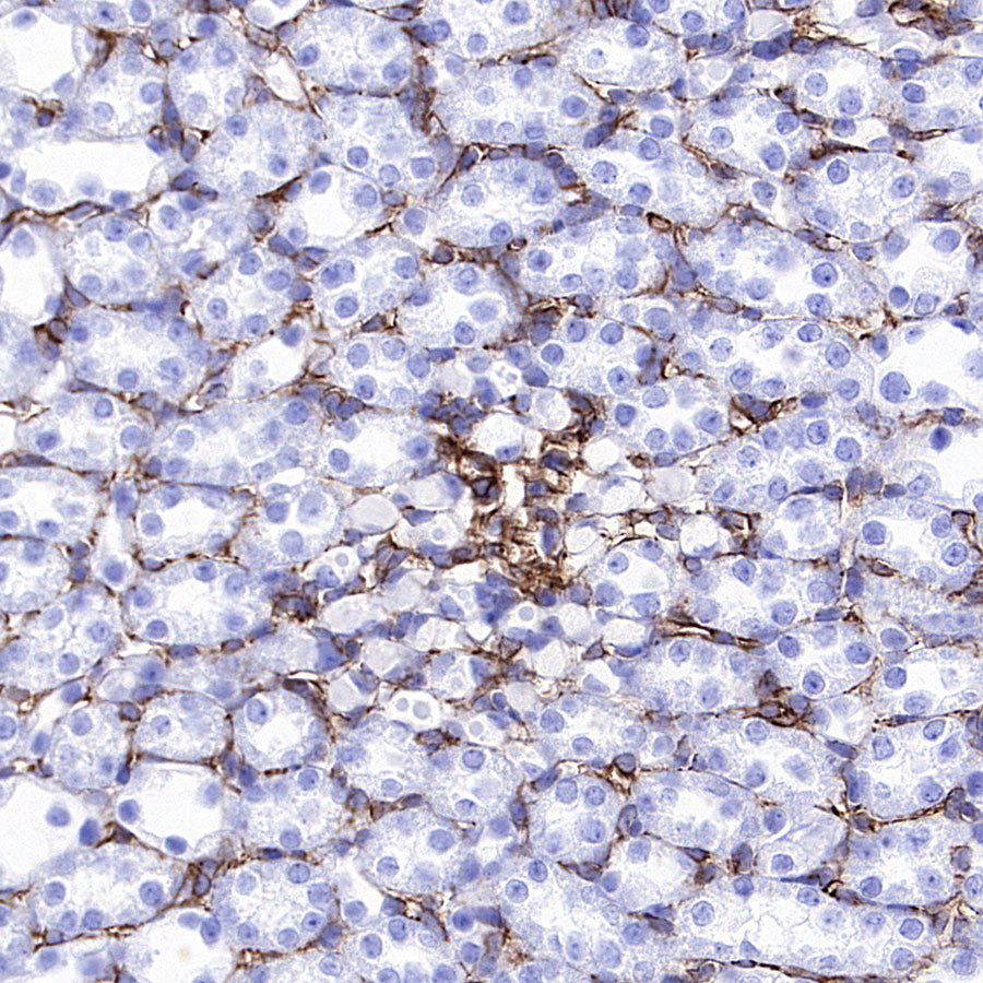 Nestin Recombinant Rabbit mAb (S-5471)