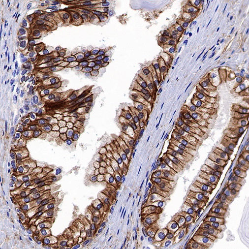 NDRG1 Recombinant Rabbit mAb (S-623-82)