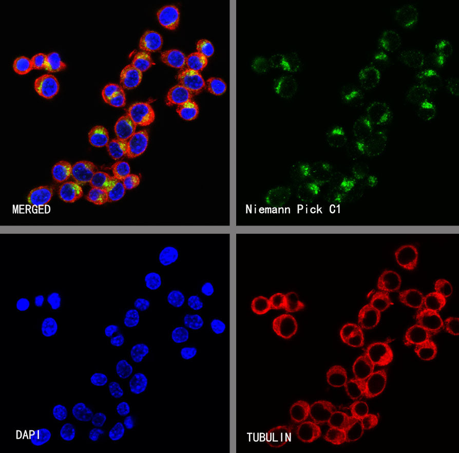 Niemann Pick C1 Recombinant Rabbit mAb (S-5243)