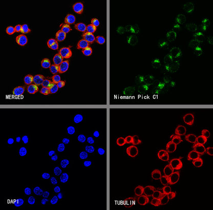 Niemann Pick C1 Recombinant Rabbit mAb (S-5243)